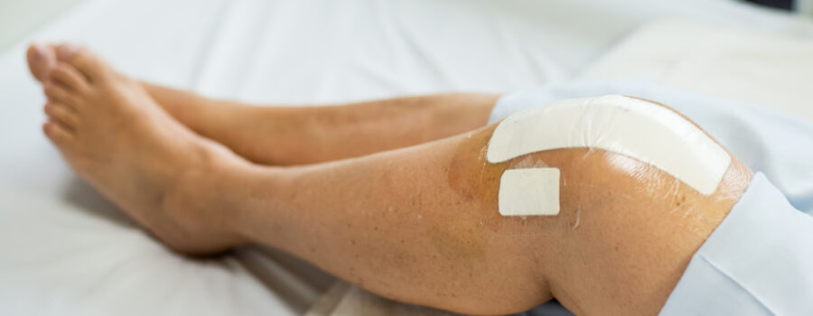 Knee Replacement Therapy