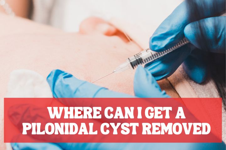 Where can I get a pilonidal cyst removed