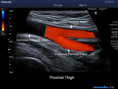 Doppler ultrasound in Lahore