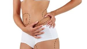 Liposuction Surgery in Dubai