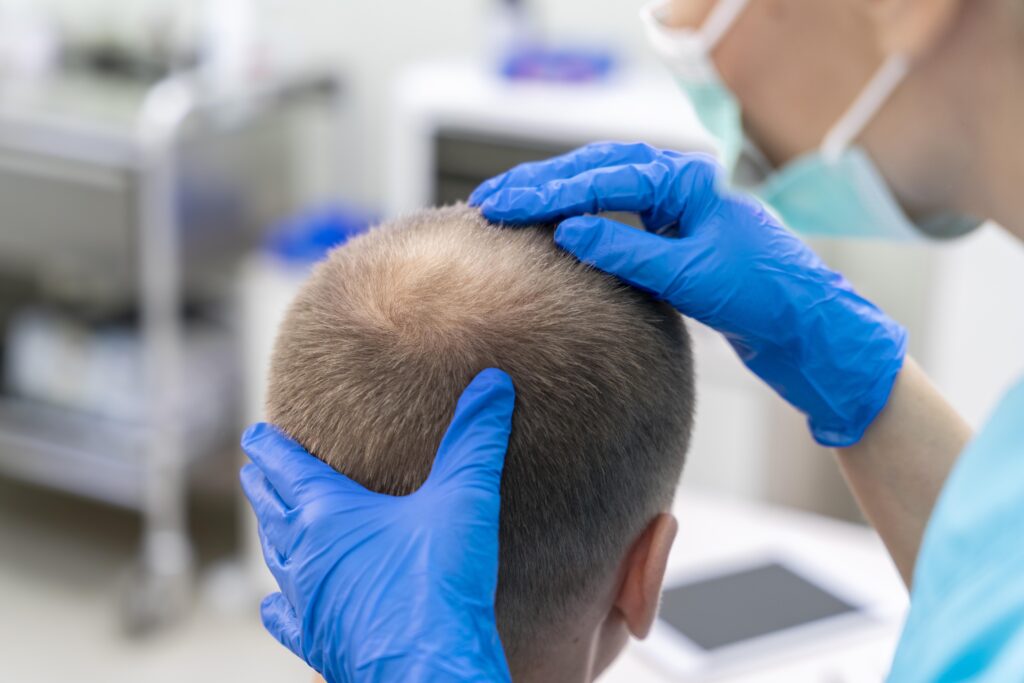 hair transplant cost in Dubai