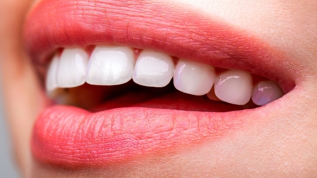 five benefits of teeth whitening