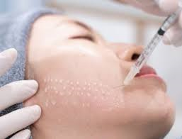 Mesotherapy in Riyadh