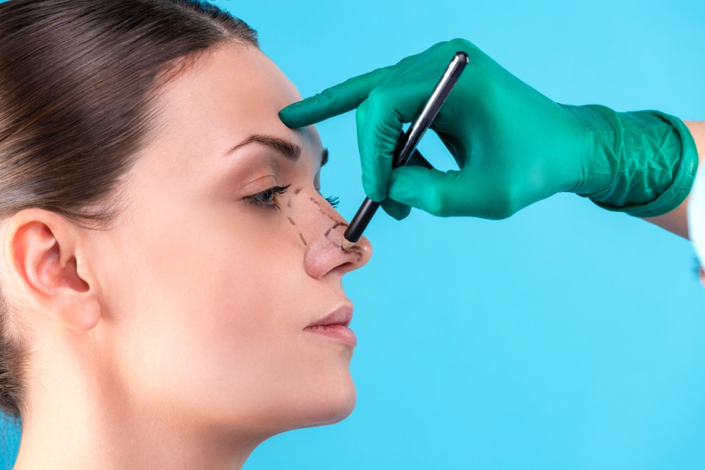 How to Prepare for a Closed Rhinoplasty