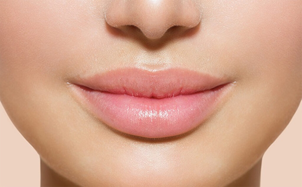 Lip filler injections in Dubai