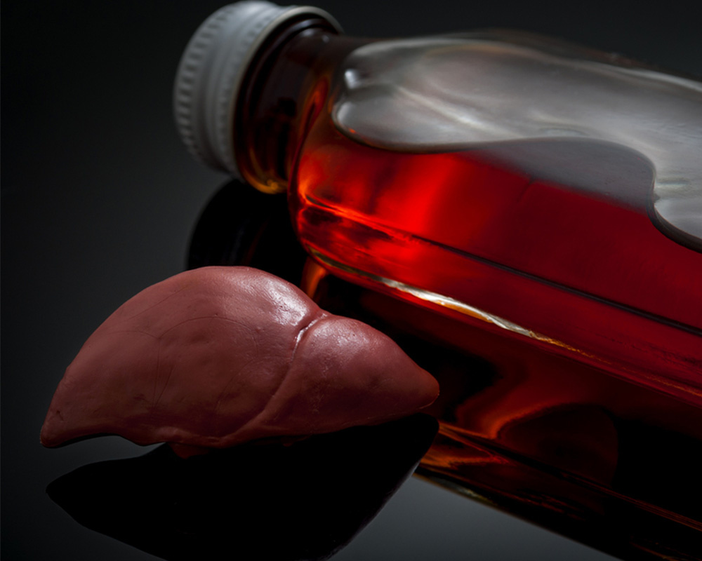 Liver Cirrhosis Treatment in Dubai