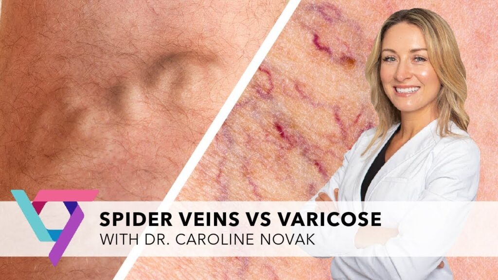 what kind of doctor is a vein specialist