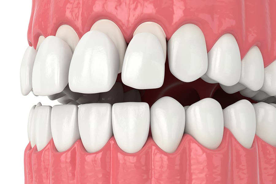 restoration dental in Beaverton OR