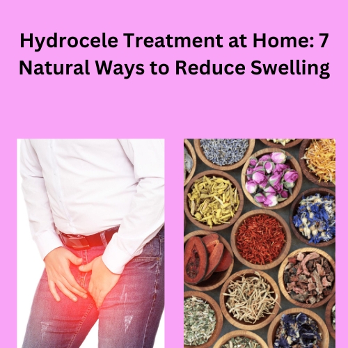 Hydrocele Treatment at Home