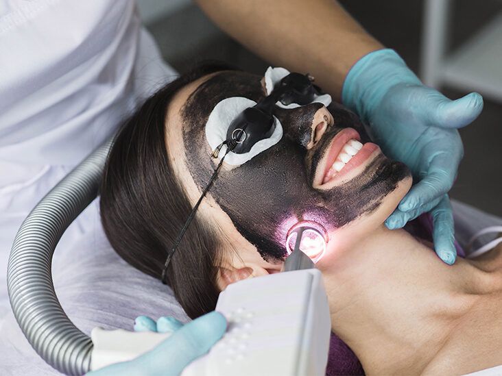 The Science Behind Laser Carbon Peel and Its Benefits