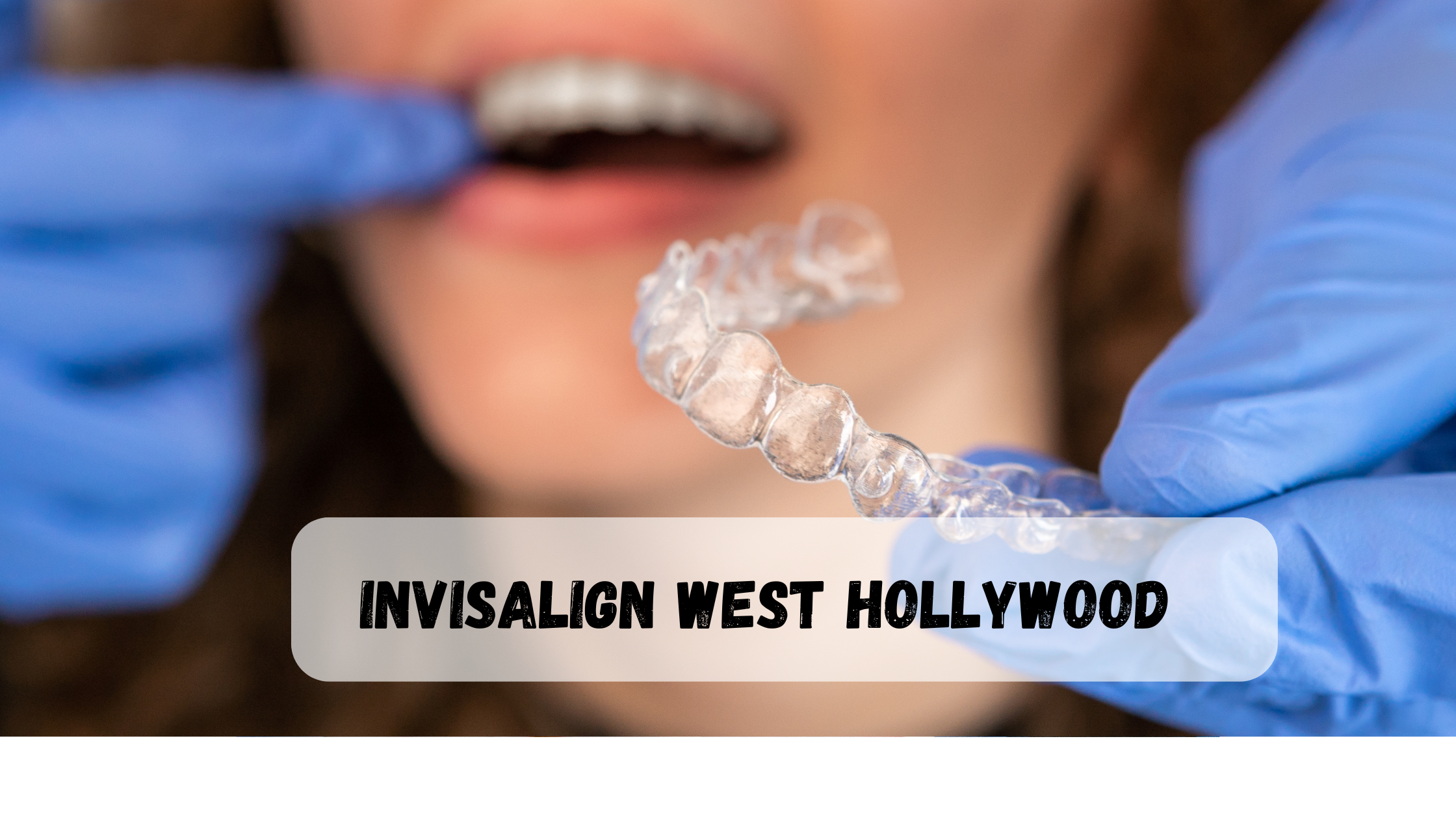 Invisalign West Hollywood